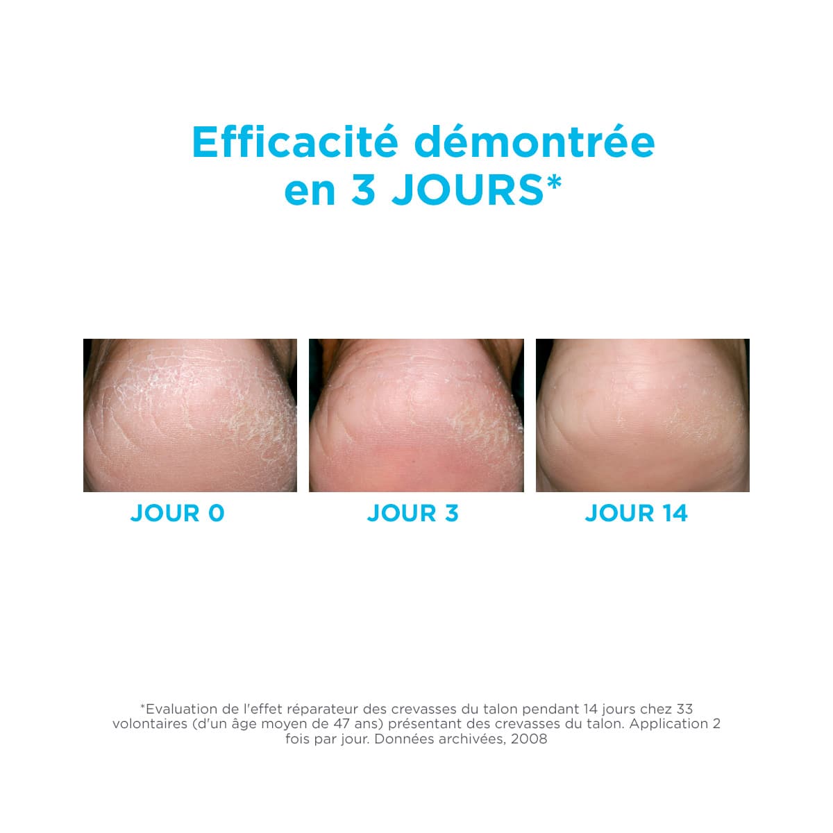 ISDIN UREADIN CRÈME DES PIEDS 75ML